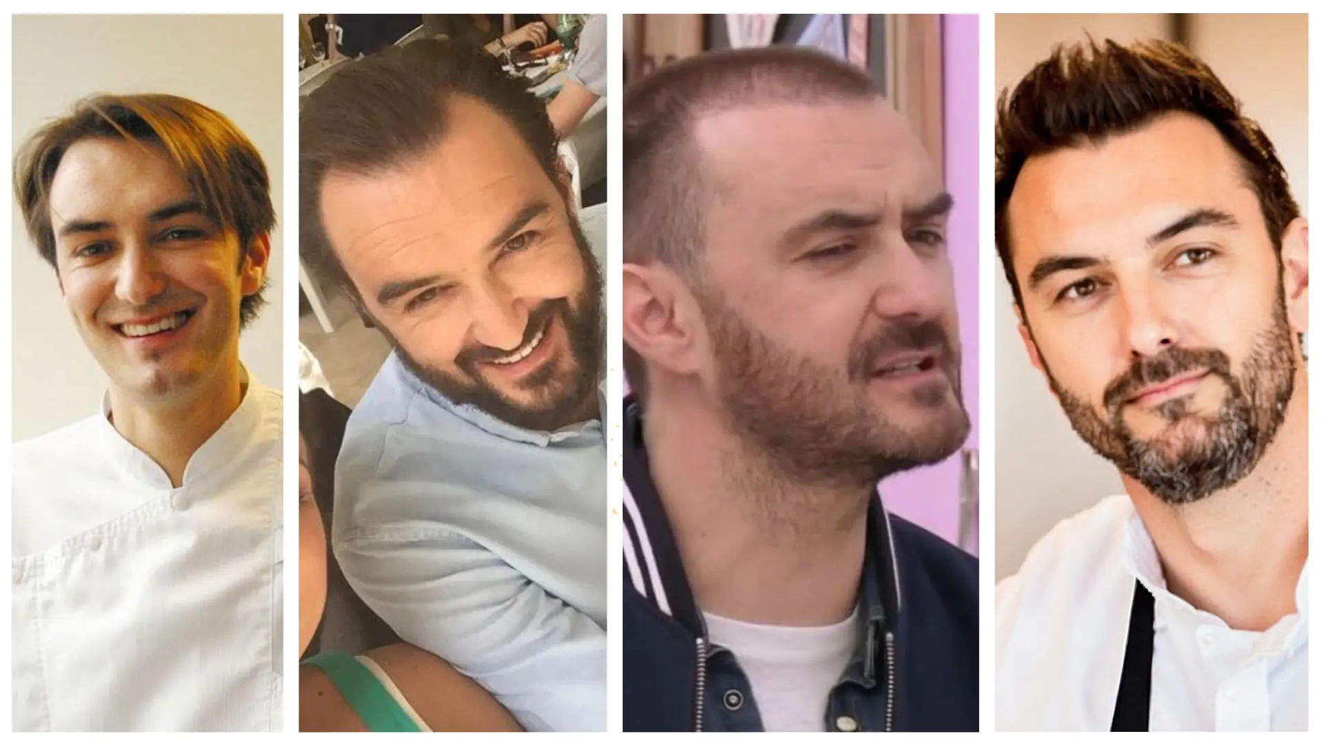 Évolution capillaire de Cyril Lignac : avant après sa greffe de cheveux